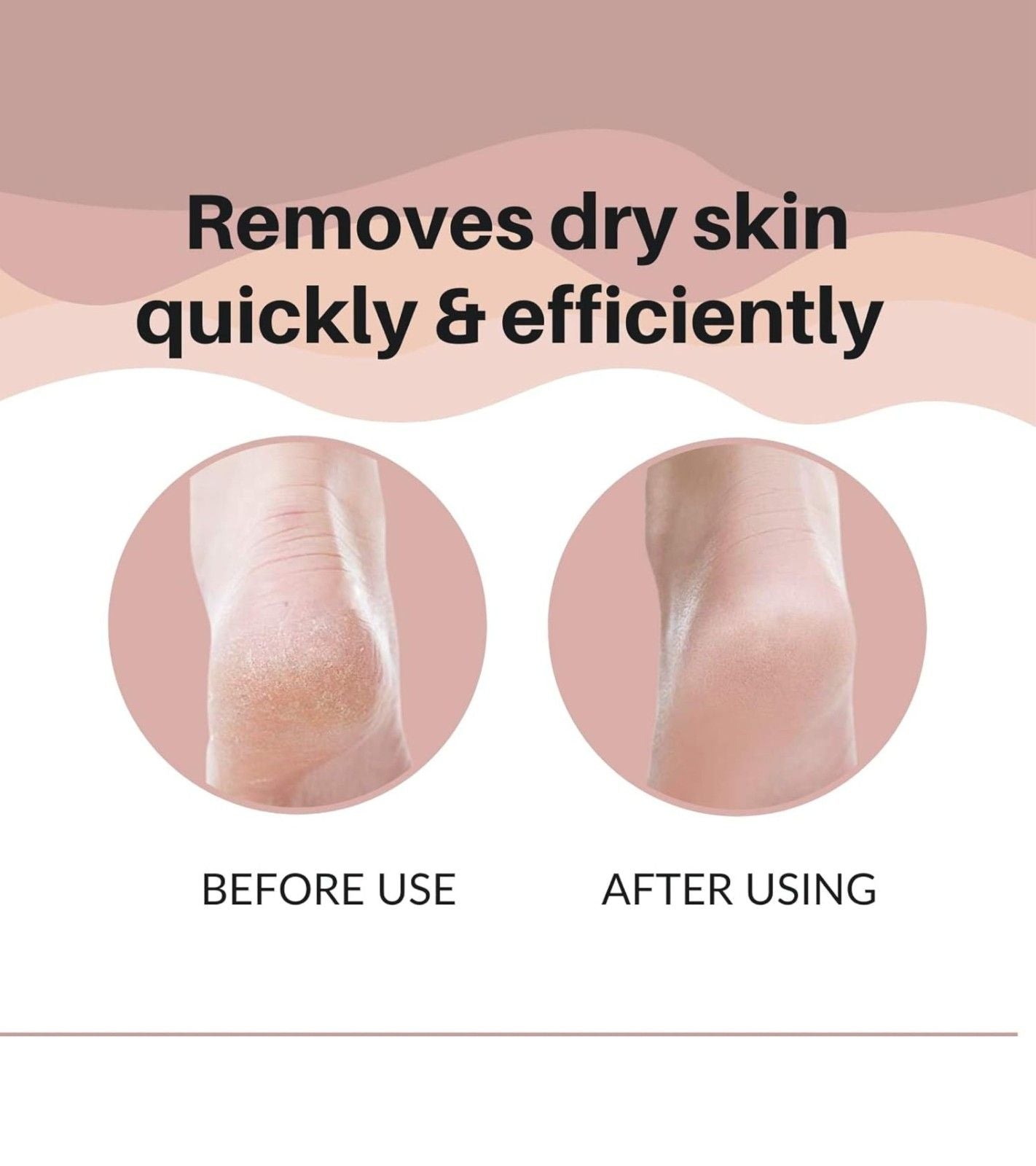 Professional Stainless Steel Laser Foot Scraper – Callus Remover & Hard Skin Filer for Men & Women, Pedicure Foot Scrubber Tool