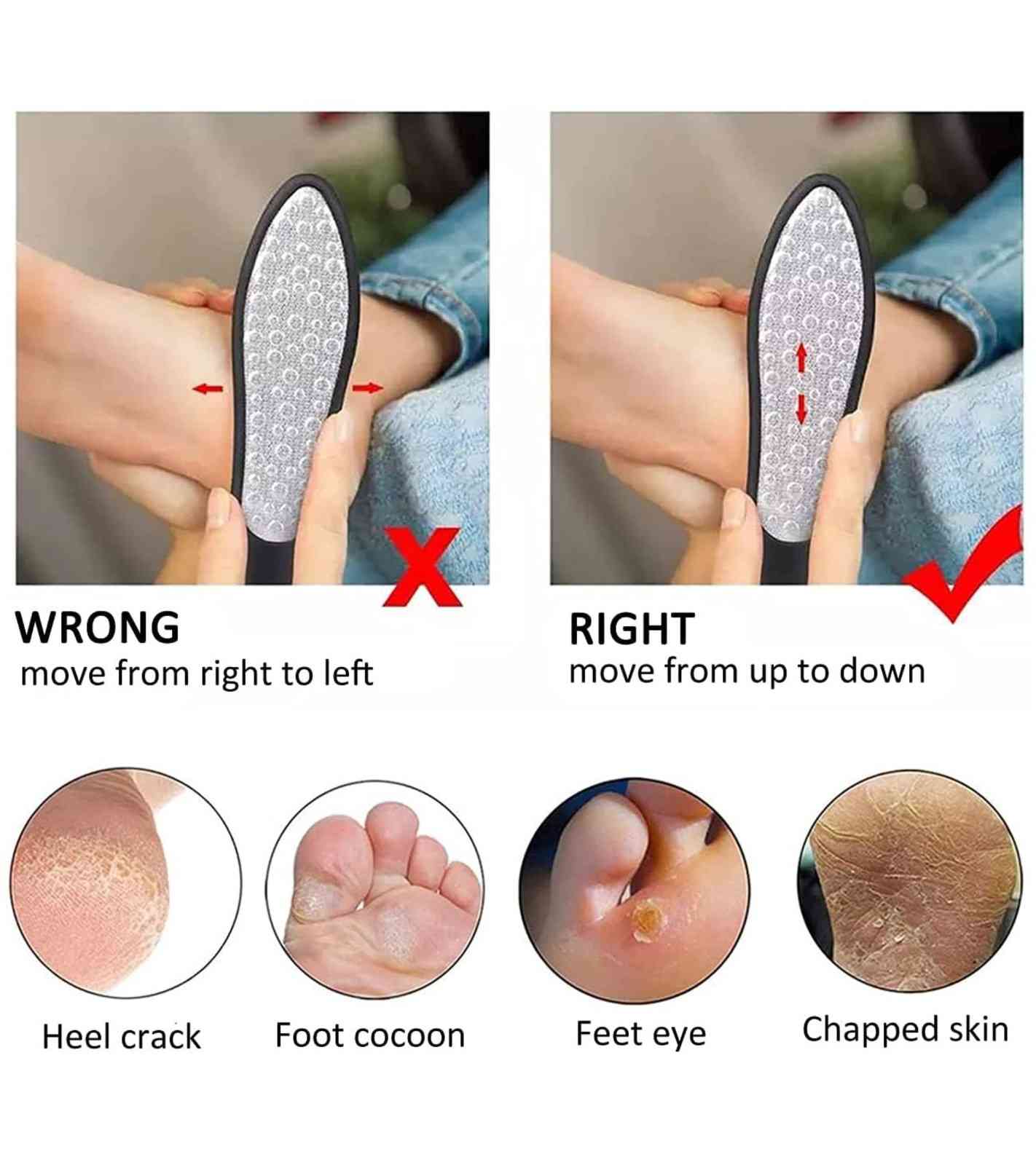 Foot File – Double-Sided Pedicure Rasp for Callus & Hard Skin Removal | Medical Grade Foot Scraper for Salon & Home Use